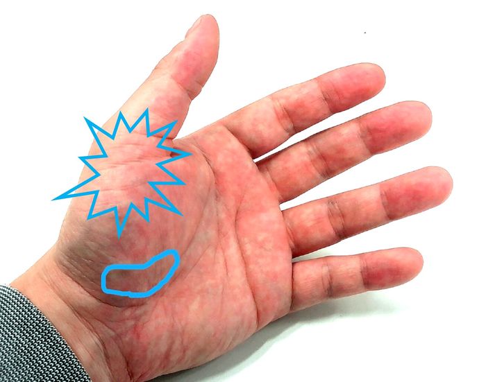 松山英樹の 左手親指痛 を経験者と考える マスターズには間に合うのか ゴルフ総合サイト Alba Net 松山英樹の 左手親指痛 を経験者と考える マスターズには間に合うのか ゴルフ総合サイト Alba Net